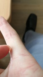 Finger.jpg